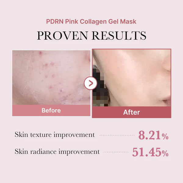 Medicube Collagen Gell Mask