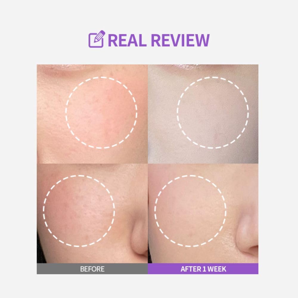 Meoru Podo Serum