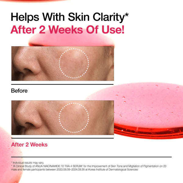 Anua Niacinamide 10% + TXA Set