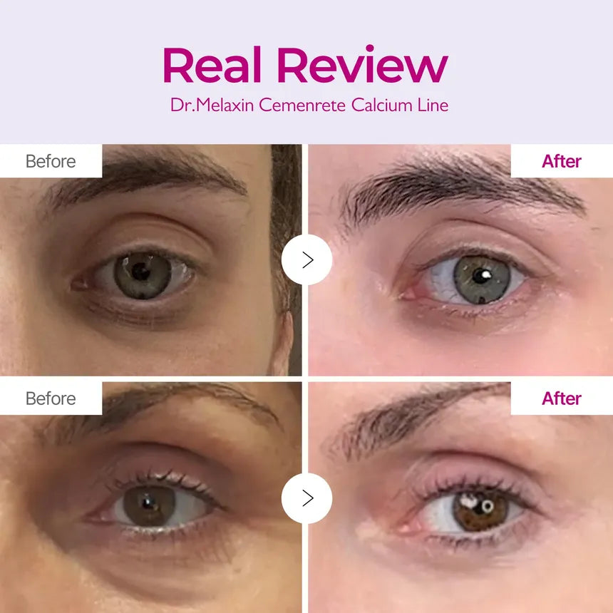 Dr.Melaxin - Cemenrete Calcium Intense Cream