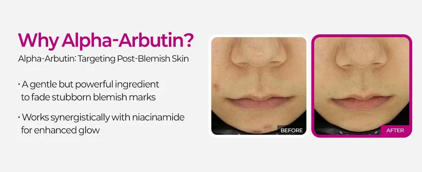 Dr.Melaxin - Cemenrete Picotonic Shot Pigmentation Serum