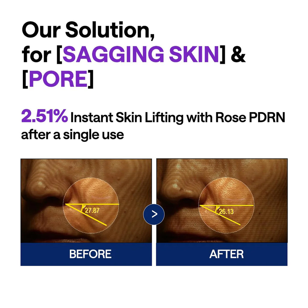 Mediheal PDRN Pore Tightening Lifting Set